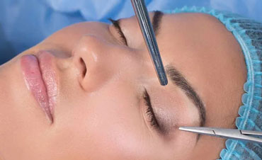 کاندید مناسب جراحی پلک