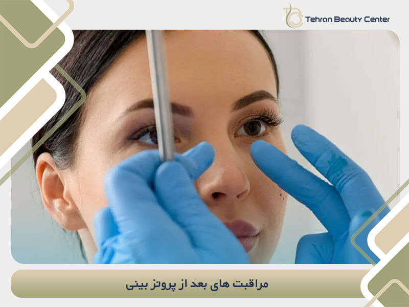 مراقبت های بعد از پروتز بینی