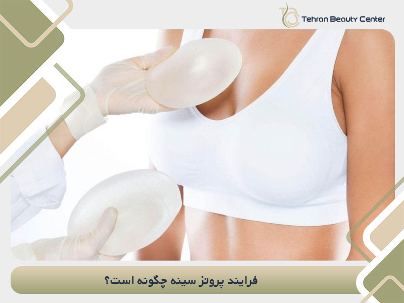 فرایند پروتز سینه چگونه است؟