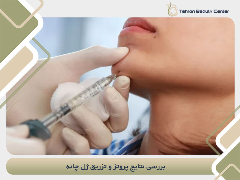 بررسی نتایج پروتز چانه و تزریق ژل چانه