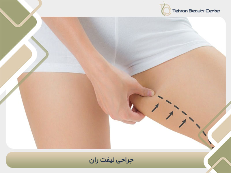 جراحی لیفت ران