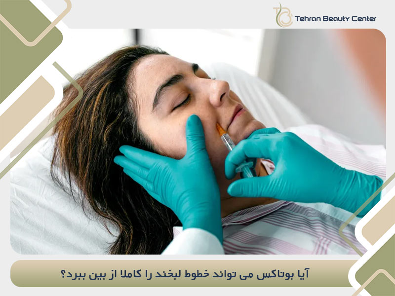آیا بوتاکس می تواند خطوط لبخند را کاملا از بین ببرد؟