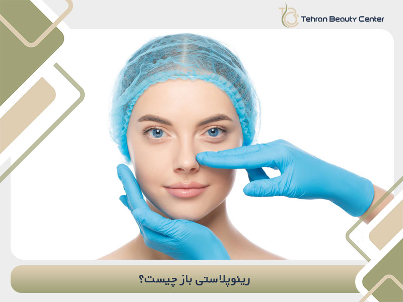 رینوپلاستی باز چیست؟