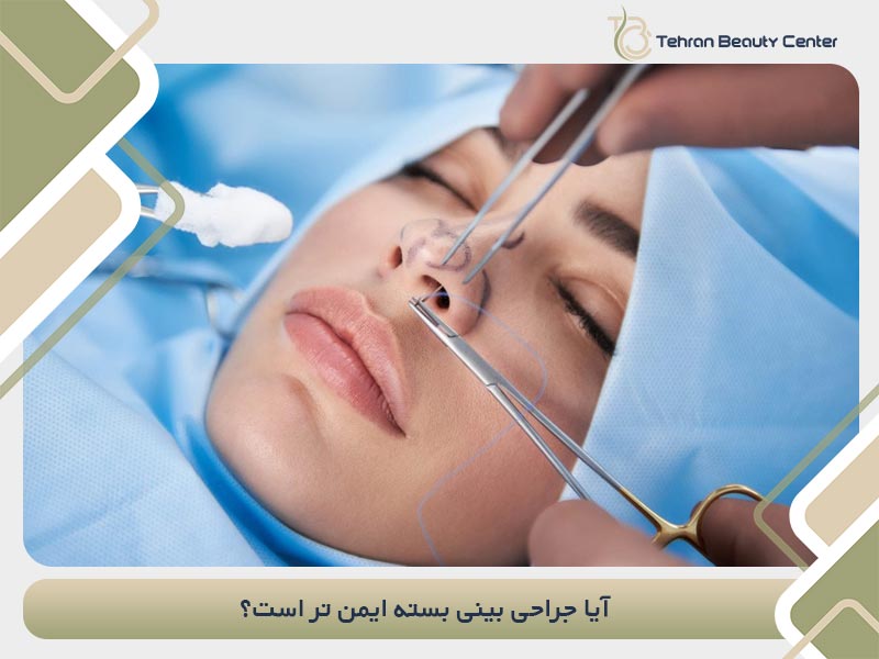 آیا جراحی بینی بسته ایمن تر است؟