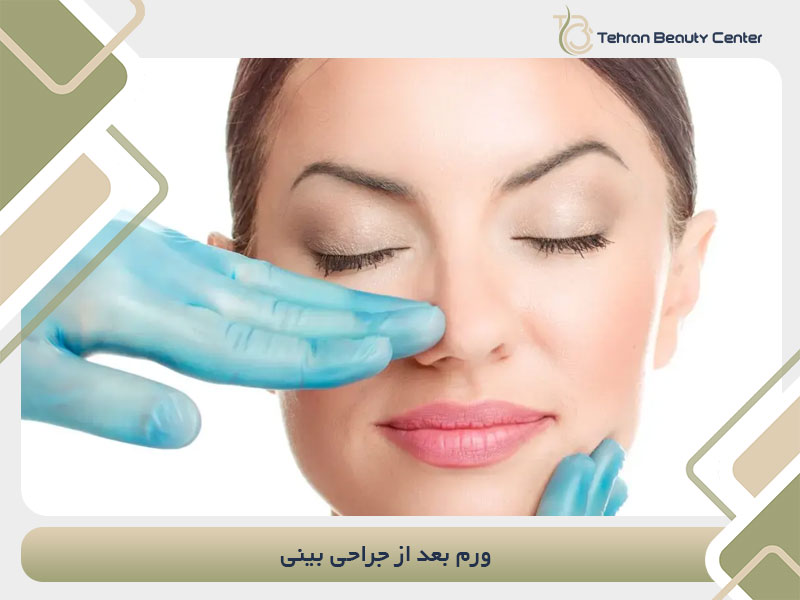 ورم بعد از جراحی بینی