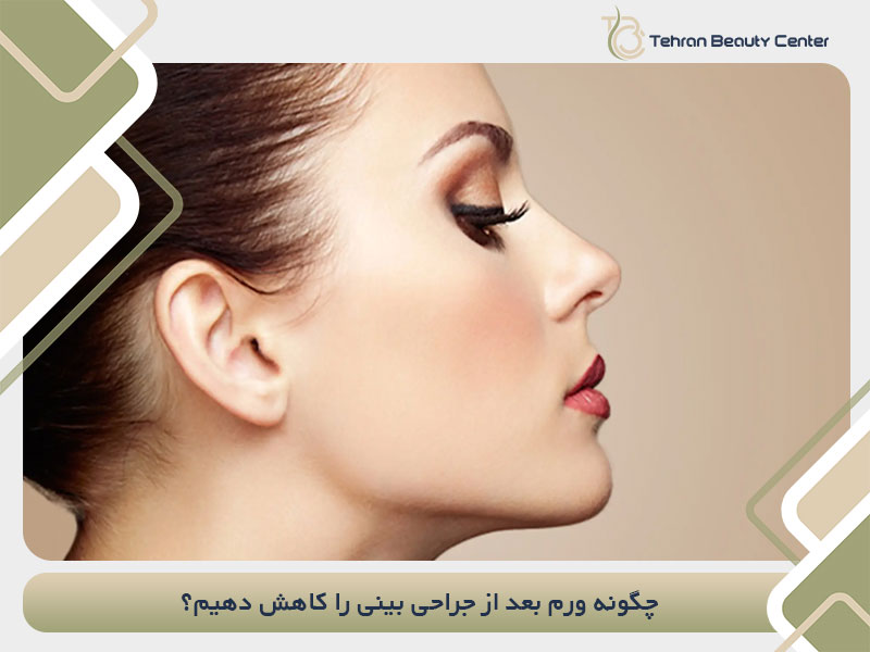 چگونه ورم بعد از جراحی بینی را کاهش دهیم؟