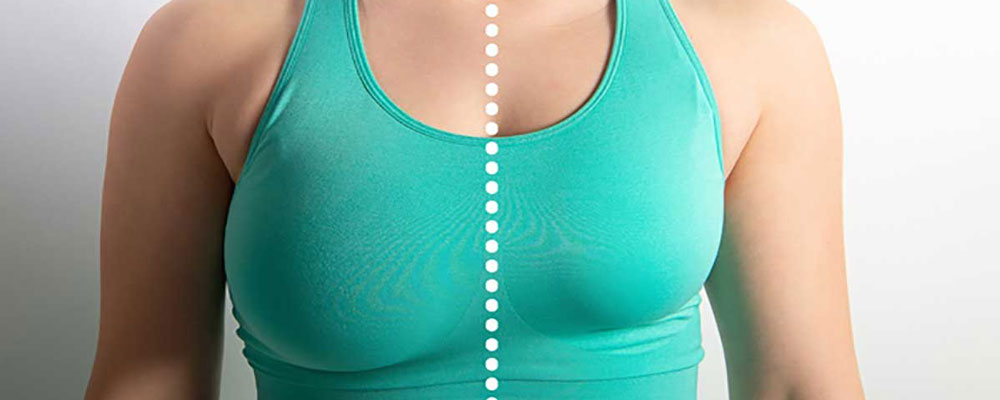 ماموپلاستی