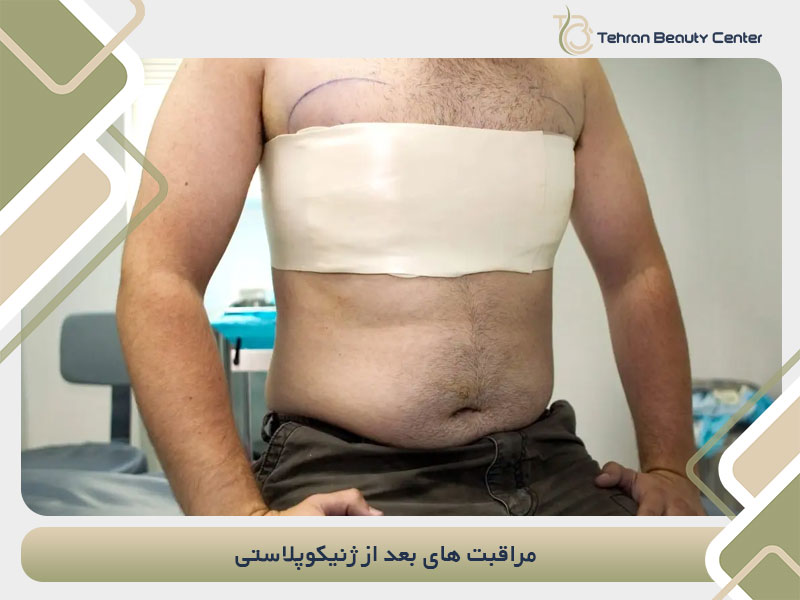 مراقبت های بعد از ژنیکوپلاستی