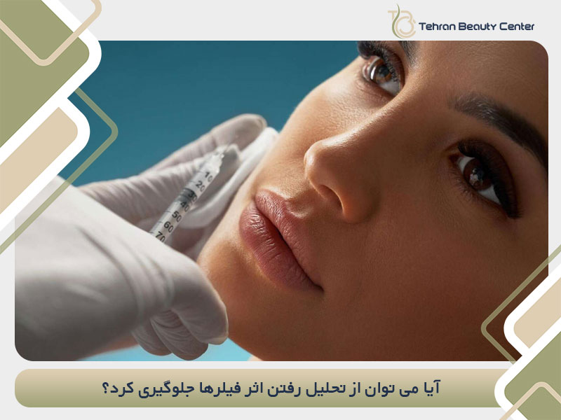 آیا می توان از تحلیل رفتن اثر فیلرها جلوگیری کرد؟