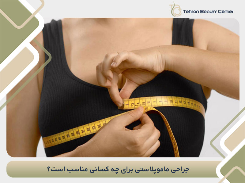 ماموپلاستی برای چه کسانی مناسب است؟