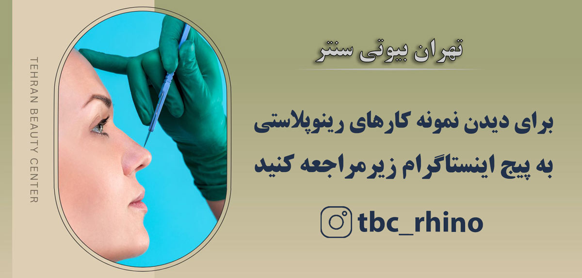 رینوپلاستی