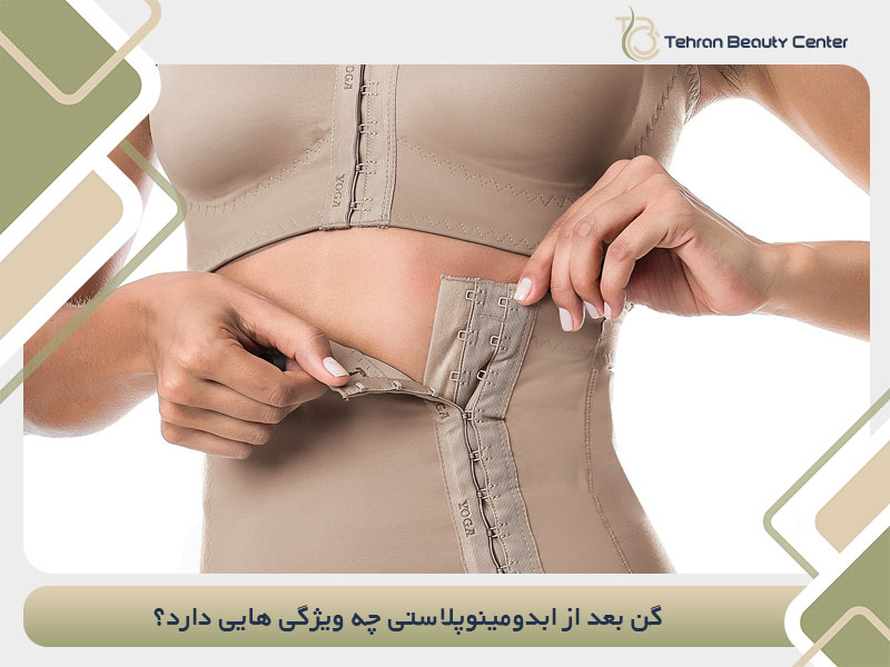 گن بعد از ابدومینوپلاستی چه ویژگی هایی دارد؟