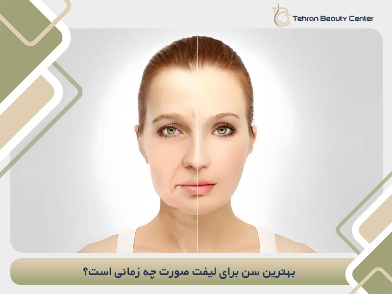 بهترین سن برای لیفت صورت چه زمانی است؟