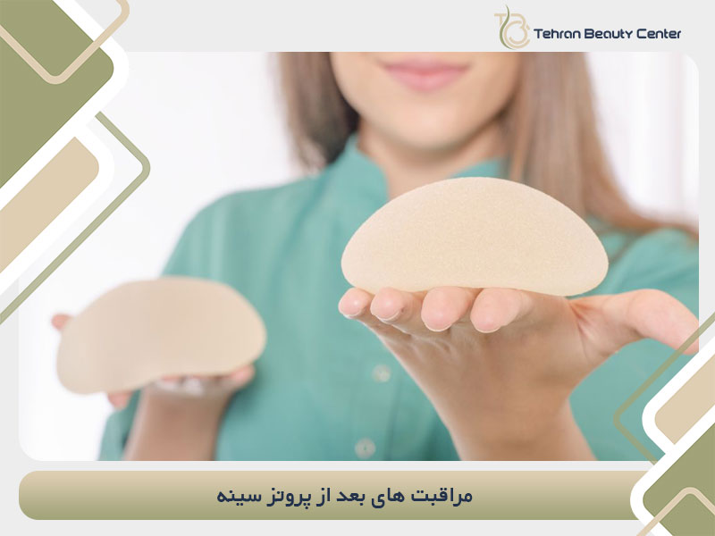 مراقبت های بعد از پروتز سینه