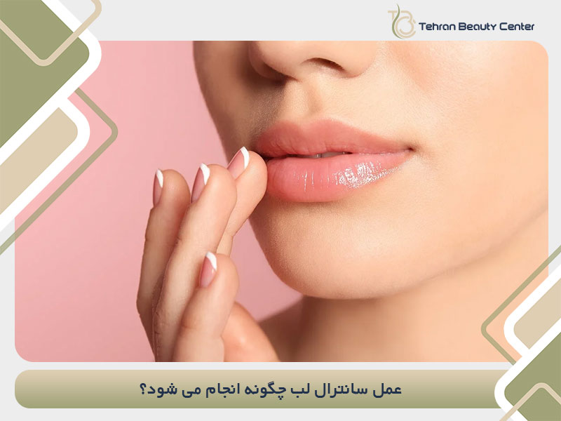 عمل سانترال لب چگونه انجام می شود؟