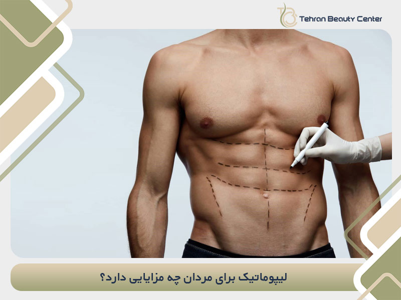 لیپوماتیک برای مردان چه مزایایی دارد؟