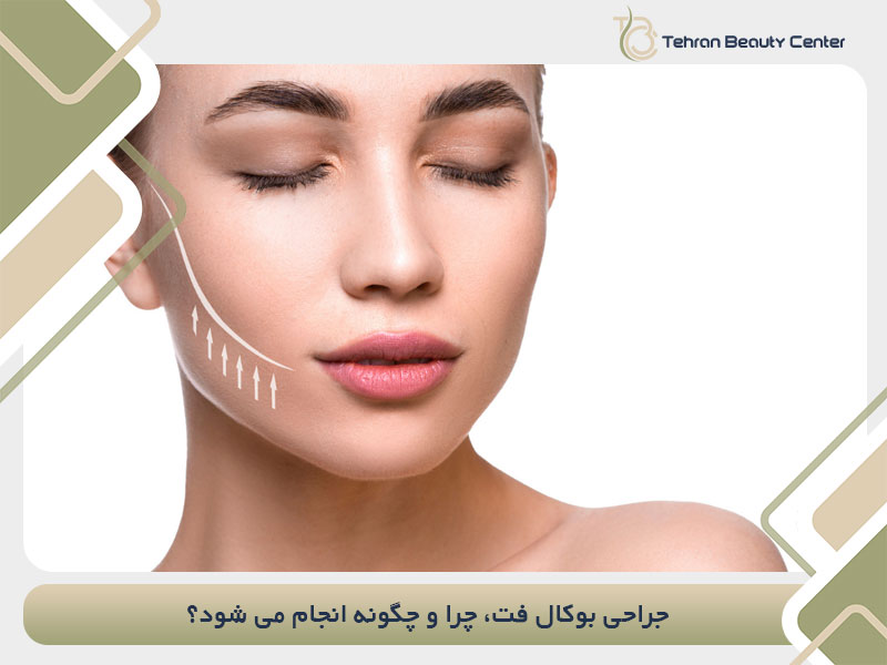 جراحی بوکال فت، چرا و چگونه انجام می شود؟