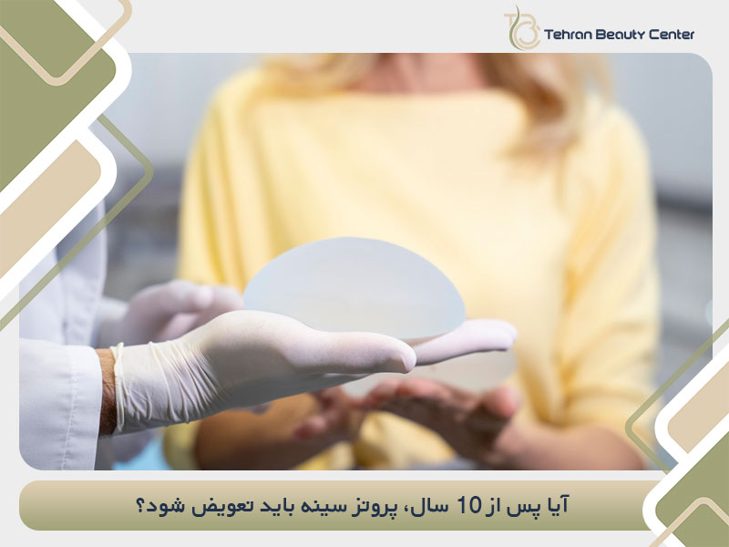 آیا پس از 10 سال، پروتز سینه باید تعویض شود؟