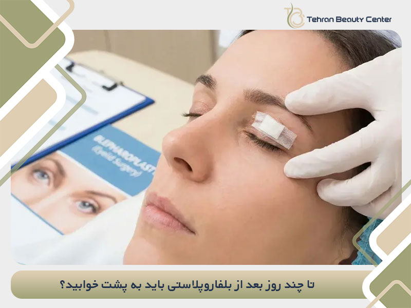 تا چند روز بعد از بلفاروپلاستی باید به پشت خوابید؟