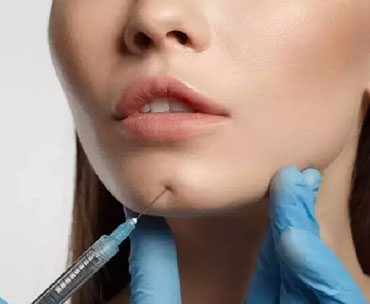 تزریق ژل به چانه