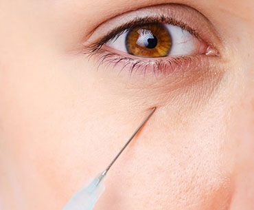 تزریق ژل به زیر چشم