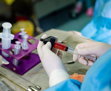 تزریق چربی به واژن