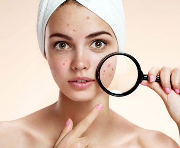 تزریق ژل به جای جوش