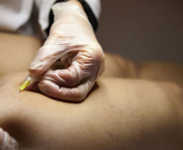 تزریق چربی دست و پا